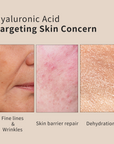 Complex Hyaluronic Acid Serum