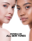 Acne Clear Patch Over-Zit | 138 Patches