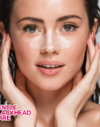 Acne Variety Patch Over-Zit | 84 Patches