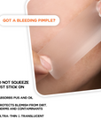 Acne Clear Patch XL Over-Zit | 14 Patches