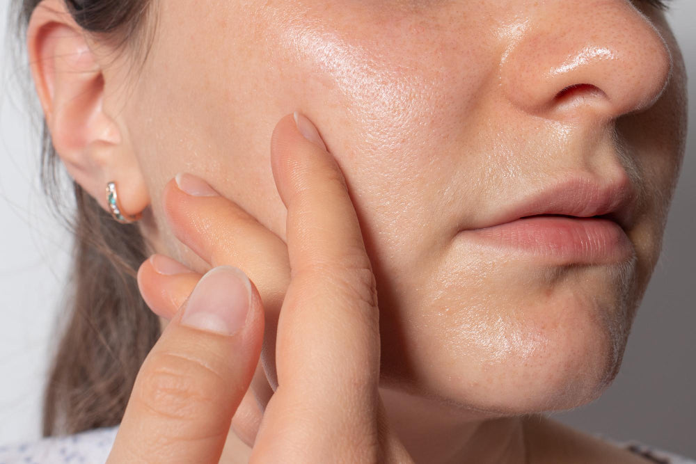 How to Build a Korean Skincare Routine for Oily Skin