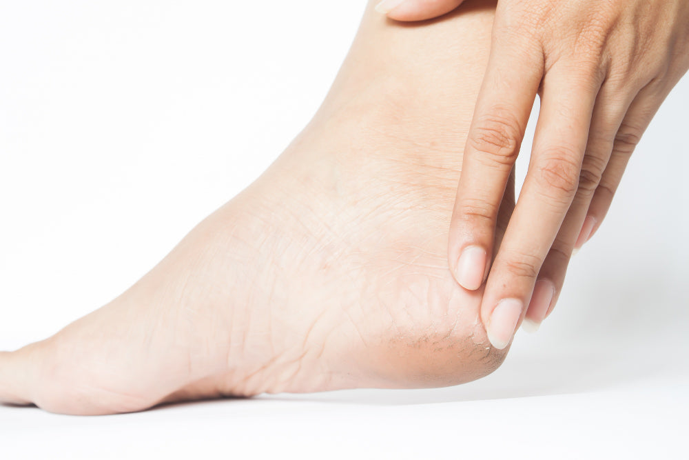 Foot Care Routine for Keeping Feet Soft in Dry Climates