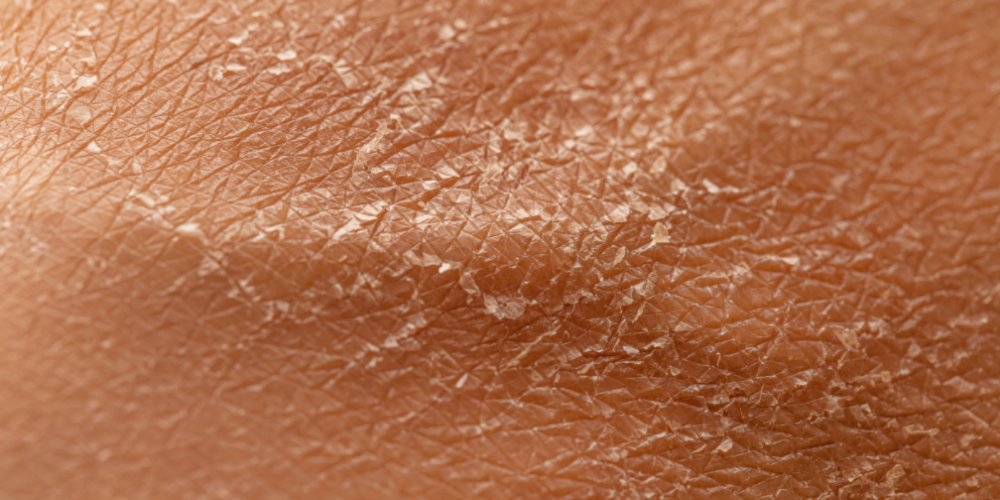 How to Actually Figure Out Your Skin Type